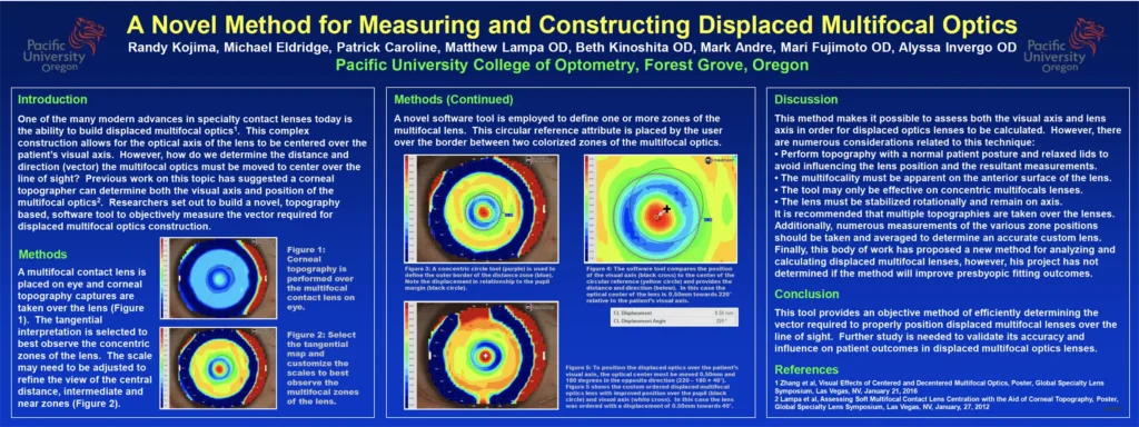 Determinar la zona óptica de la lente respecto del centro pupilar con software de procesamiento de imágenes ImageJ.