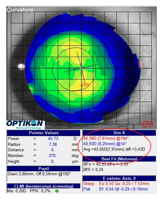 Sim k: Representa el poder y la ubicación de los meridianos principales de la córnea. Es equivalente a la queratometría que nos proporciona el queratómetro. Con el podremos: • Calcular los radios de una lente RPG corneal o una lente blanda.